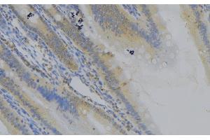 ABIN6279109 at 1/100 staining Mouse colon tissue by IHC-P.