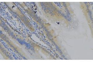 ABIN6279109 at 1/100 staining Mouse colon tissue by IHC-P. (CTNNAL1 anticorps  (Internal Region))