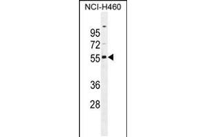 Western blot analysis in NCI-H460 cell line lysates (35ug/lane). (RASSF8 anticorps  (N-Term))