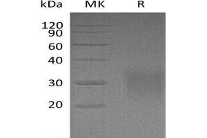 Western Blotting (WB) image for CD83 (CD83) (AA 22-134) protein (His tag) (ABIN7320709)