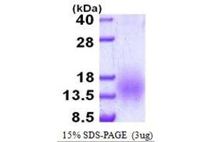 ESAT6 protein (His tag)
