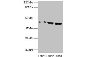 Western blot All lanes: CAMK1Dantibody at 2. (CAMK1D anticorps  (AA 1-180))