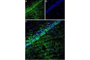 Expression of TARP γ8 (CACNG8) in rat hippocampus - Immunohistochemical staining of rat hippocampus using Anti-CACNG8 Antibody (ABIN7042996, ABIN7044073 and ABIN7044074). (CACNG8 anticorps  (Intracellular, N-Term))
