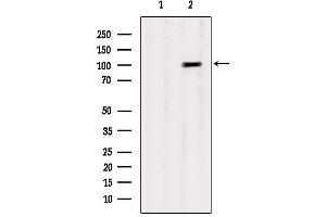 Western blot analysis of extracts from B16F10, using CTNNA1 Antibody. (CTNNA1 anticorps  (Internal Region))