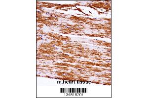 Mouse Map3k5 Antibody immunohistochemistry analysis in formalin fixed and paraffin embedded mouse heart tissue followed by peroxidase conjugation of the secondary antibody and DAB staining.