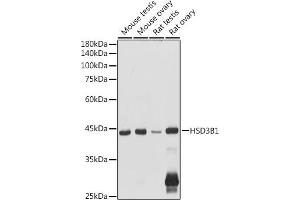 Western blot analysis of extracts of various cell lines, using HSD3B1 antibody (ABIN6131041, ABIN6142016, ABIN6142017 and ABIN6224059) at 1:1000 dilution. (HSD3B1 anticorps  (AA 1-290))