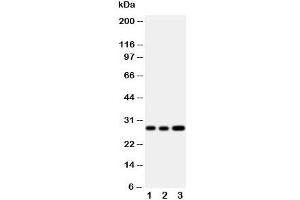 Western blot testing of Oncostatin M antibody and Lane 1:  A549;  2: A549;  3: HeLa cell lysate (Oncostatin M anticorps  (Middle Region))