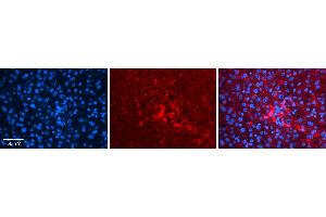 Rabbit Anti-FNTA Antibody   Formalin Fixed Paraffin Embedded Tissue: Human Liver Tissue Observed Staining: Cytoplasm in hepatocytes Primary Antibody Concentration: 1:100 Other Working Concentrations: N/A Secondary Antibody: Donkey anti-Rabbit-Cy3 Secondary Antibody Concentration: 1:200 Magnification: 20X Exposure Time: 0.