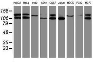 Image no. 2 for anti-SUMO1/sentrin/SMT3 Specific Peptidase 2 (SENP2) (AA 139-523) antibody (ABIN1490928) (SENP2 anticorps  (AA 139-523))
