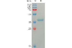 S100 Calcium Binding Protein A4 (S100A4) (AA 2-101) protein (Fc Tag)