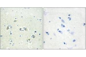 Immunohistochemistry analysis of paraffin-embedded human brain tissue, using GAS6 Antibody. (GAS6 anticorps  (AA 291-340))