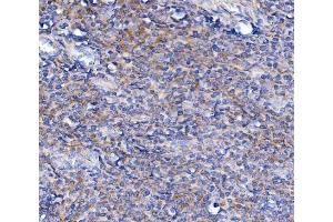 IHC analysis of TRIM6 using anti-TRIM6 antibody (ABIN7601905). (TRIM6 anticorps  (AA 50-349))