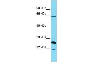 Host:  Rabbit  Target Name:  HCFC1  Sample Type:  Uterus Tumor lysates  Antibody Dilution:  1. (HCFC1 anticorps  (N-Term))