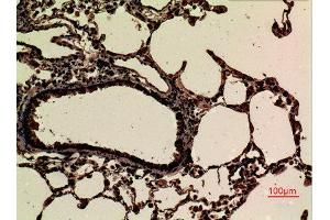 Immunohistochemistry (IHC) analysis of paraffin-embedded Rat Lung, antibody was diluted at 1:100.