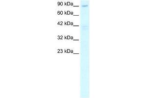 Human Heart; WB Suggested Anti-C20ORF194 Antibody Titration: 2. (C20orf194 anticorps  (C-Term))