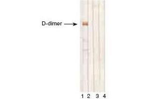 D-dimer, D-monomer and fibrinogen immunodetectionby MAb DD1 in Western blotting. (D-Dimer anticorps)