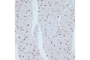 Immunohistochemistry of paraffin-embedded rat heart using Phospho-Chk1-S280 antibody (ABIN3019445, ABIN3019446, ABIN3019447 and ABIN6225372) at dilution of 1:100 (40x lens). (CHEK1 anticorps  (pSer280))