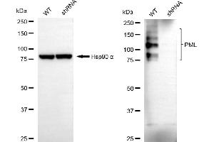 Western blotting analysis using PML antibody (ABIN7799924).