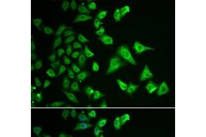 Immunofluorescence analysis of HeLa cells using DHRS2 Polyclonal Antibody (DHRS2 anticorps)