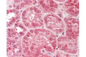 Human Kidney: Formalin-Fixed, Paraffin-Embedded (FFPE).