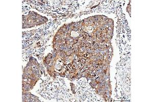 IHC analysis of Integrin alpha 3/ITGA3 using anti-Integrin alpha 3/ITGA3 antibody (ABIN7602696).