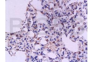 Formalin-fixed and paraffin embedded rat lung tissue labeled with Anti-IFN-gamma Polyclonal Antibody, Unconjugated (ABIN669126) at 1:200, followed by conjugation to the secondary antibody and DAB staining (Interferon gamma anticorps  (AA 75-155))