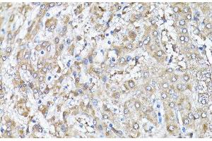 Immunohistochemistry of paraffin-embedded Human liver using Snail Polyclonal Antibody at dilution of 1:100 (40x lens). (SNAIL anticorps)