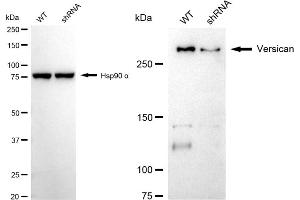 Western blotting analysis using versican antibody (ABIN7800829).