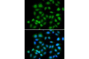 Immunofluorescence analysis of HeLa cells using MXI1 antibody. (MXI1 anticorps)