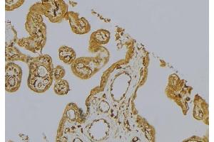 ABIN6276782 at 1/100 staining Mouse placenta tissue by IHC-P.