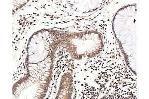 Immunohistochemistry analysis of paraffin-embedded human colon using LEP Polyclonal Antibody at dilution of 1:100.