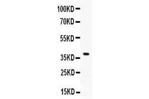 Western blot analysis of RANKL expression in rat brain extract ( Lane 1). (RANKL anticorps  (AA 141-318))