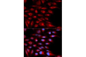 Immunofluorescence (IF) image for anti-alpha-2-Glycoprotein 1, Zinc-Binding (AZGP1) antibody (ABIN1876553) (AZGP1 anticorps)