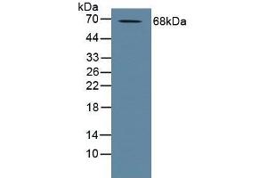 Detection of ADAM10 in Human Placenta Tissue using Polyclonal Antibody to A Disintegrin And Metalloprotease 10 (ADAM10) (ADAM10 anticorps  (AA 420-641))