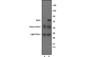 YAP1 antibody (pAb) tested by Immunoprecipitation.