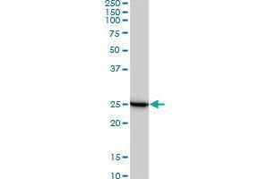 Image no. 3 for anti-Ribosomal Protein L19 (RPL19) (AA 1-101) antibody (ABIN465969)