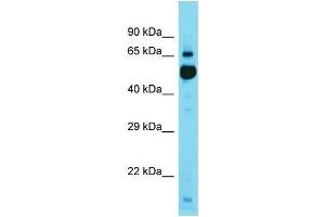Western Blotting (WB) image for anti-Kelch Repeat and BTB (POZ) Domain Containing 11 (KBTBD11) (C-Term) antibody (ABIN2791602) (KBTBD11 anticorps  (C-Term))