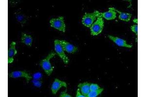 Detection of LEI in Human Hela Cell using Polyclonal Antibody to Leukocyte Elastase Inhibitor (LEI) (SERPINB1 anticorps  (AA 184-368))