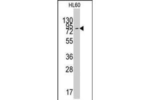 Western blot analysis of SLC16A1 polyclonal antibody  in HL-60 cell line lysates (35 ug/lane).