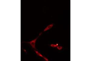 ABIN6274958 staining HepG2 cells by IF/ICC. (CA13 anticorps  (Internal Region))