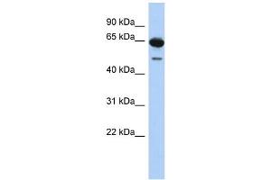 WB Suggested Anti-DAZ1 Antibody Titration: 0. (DAZ1 anticorps  (N-Term))