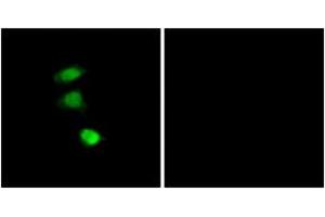 Immunofluorescence (IF) image for anti-Insulin Receptor Substrate 1 (IRS1) (pSer307) antibody (ABIN2888447) (IRS1 anticorps  (pSer307))