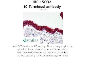 Image no. 2 for anti-SCO2 Cytochrome C Oxidase Assembly Protein (SCO2) antibody (ABIN1739069) (SCO2 anticorps)