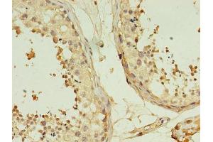 Immunohistochemistry of paraffin-embedded human testis tissue using ABIN7173059 at dilution of 1:100 (TMEM141 anticorps  (AA 1-108))