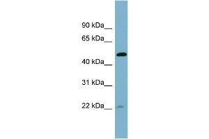WB Suggested Anti-UCHL5IP  Antibody Titration: 0. (HAUS7 anticorps  (Middle Region))