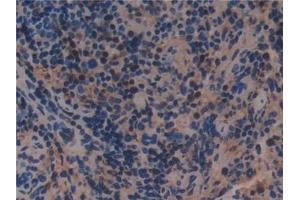 Detection of b2M in Mouse Spleen Tissue using Monoclonal Antibody to Beta-2-Microglobulin (b2M)