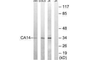 Western Blotting (WB) image for anti-Carbonic Anhydrase XIV (CA14) (Internal Region) antibody (ABIN1851004)