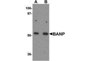 Western blot analysis of BANP in mouse kidney tissue lysate with BANP antibody at (A) 1 and (B) 2 μg/ml. (BANP anticorps  (Center))