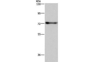 Western Blot analysis of Mouse brain tissue using PATZ1 Polyclonal Antibody at dilution of 1:250 (PATZ1 anticorps)