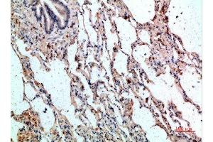Immunohistochemical analysis of paraffin-embedded human-lung, antibody was diluted at 1:200 (CD236/GYPC anticorps  (AA 11-60))